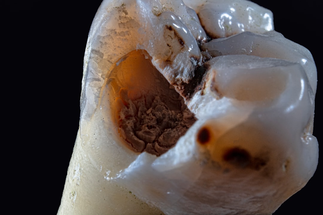 Raty na leczenie implantologiczne - czy to się opłaca?